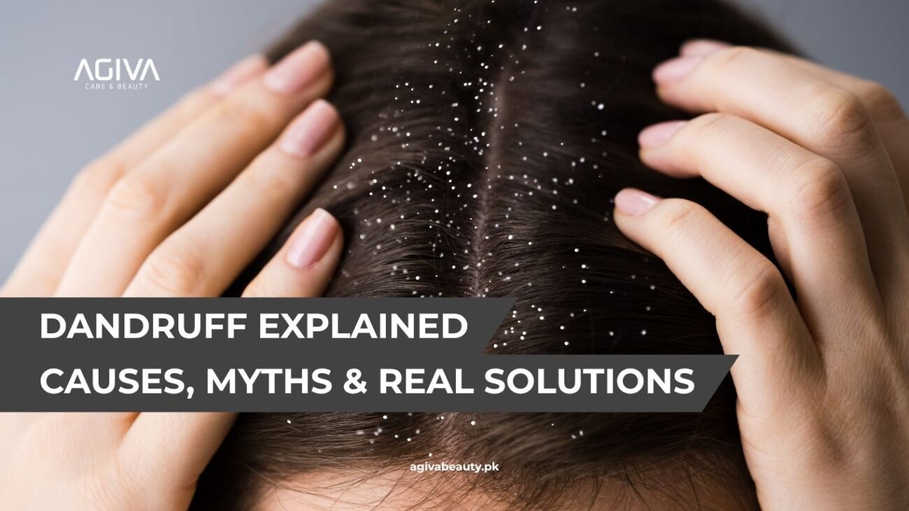 dandruff treatment in Pakistan