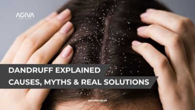dandruff treatment in Pakistan